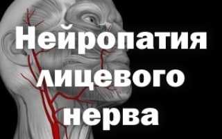Синдромы при нейропатии лицевого нерва