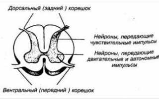 Корешковый синдром при грудном остеохондрозе лечение