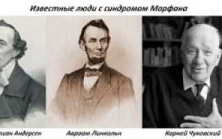 Синдром марфана признаки у новорожденного
