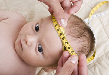 гидроцефалия