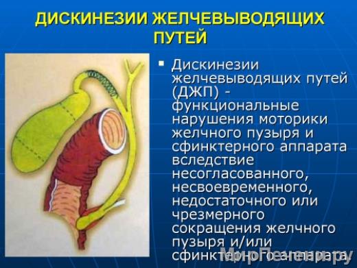 Zabolevaniya_pecheni_simptomy_i_priznaki_bolezni_zhelchnogo_puzyrya