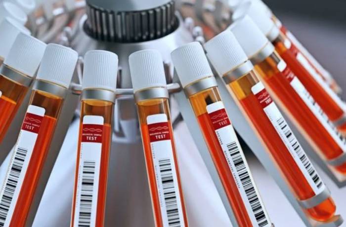 Лейкоцитарная формула позволяет определить процентное соотношения различных типов лейкоцитов