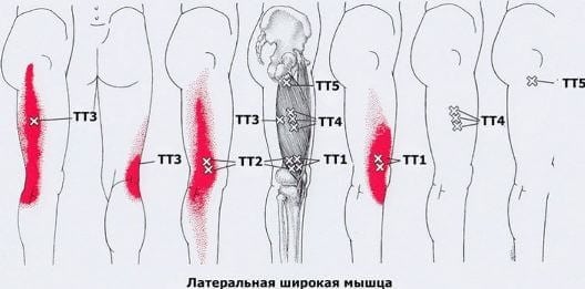 Синдром приводящей мышцы бедра причины