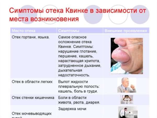 Отек код по мкб