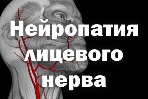 Нейропатия лицевого нерва