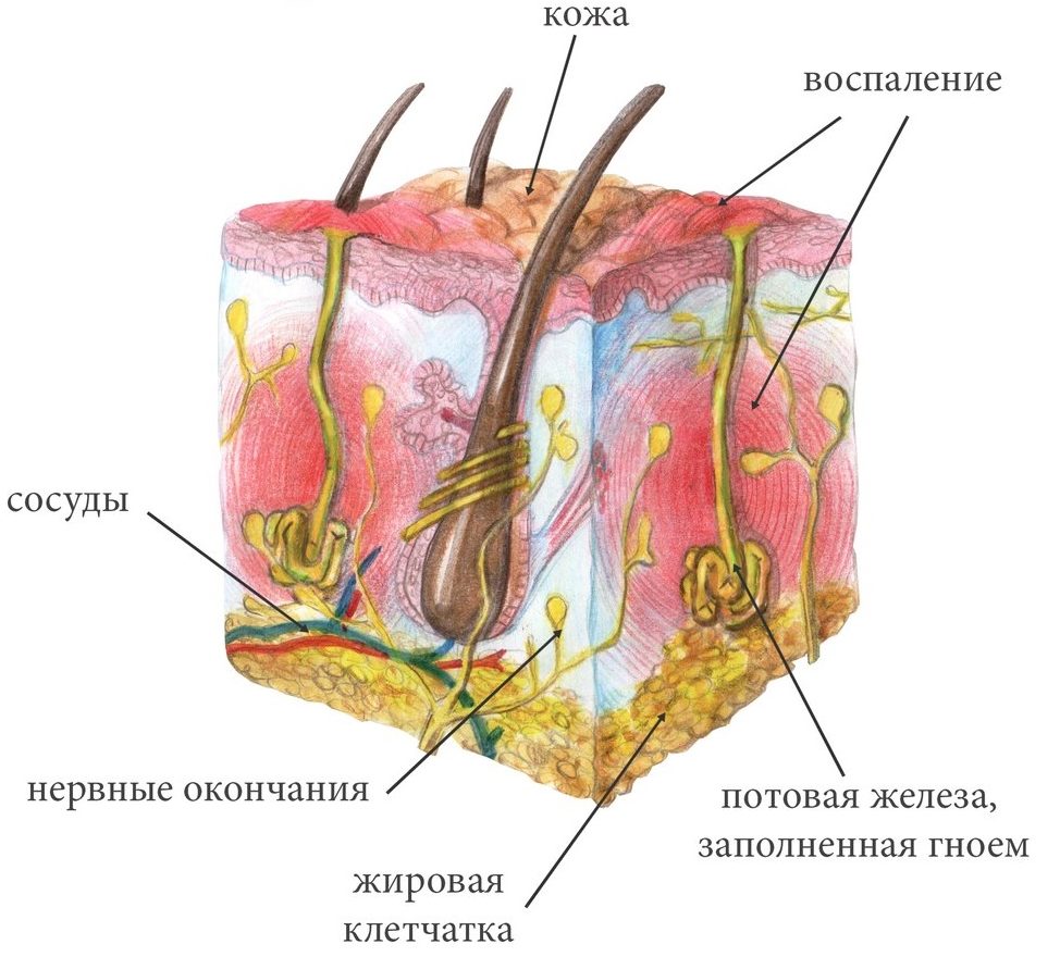 suchje-vymya-pod-myshkoj